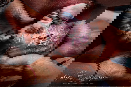 17 Potret perjuangan saat melahirkan, bukti Bunda adalah wanita tangguh