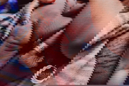 17 Potret perjuangan saat melahirkan, bukti Bunda adalah wanita tangguh