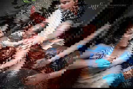 foto ibu melahirkan 6