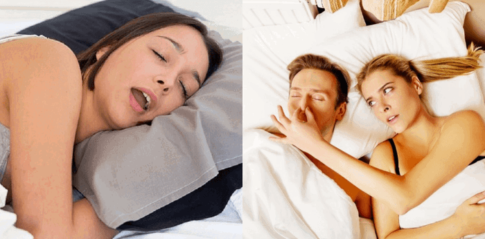 Sering tidur ngorok? Waspadai penyakit berbahaya yang menyebabkan berikut ini!