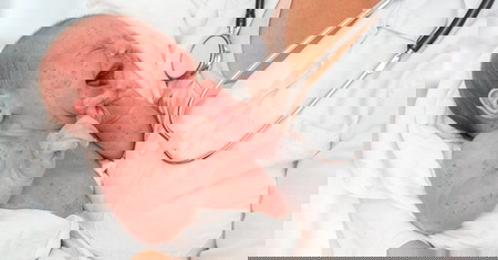 Herpes genital pada ibu hamil featured