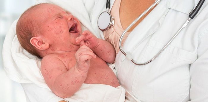 Herpes genital pada ibu hamil bisa berakibat fatal untuk janin, hati-hati!