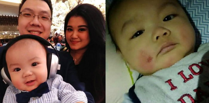 Viral bayi kena eksim parah karena disentuh sembarangan, ini tanggapan dokter