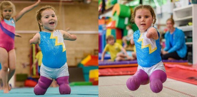 Hebat! Anak 5 tahun tanpa kaki dan tangan berprestasi di bidang olahraga