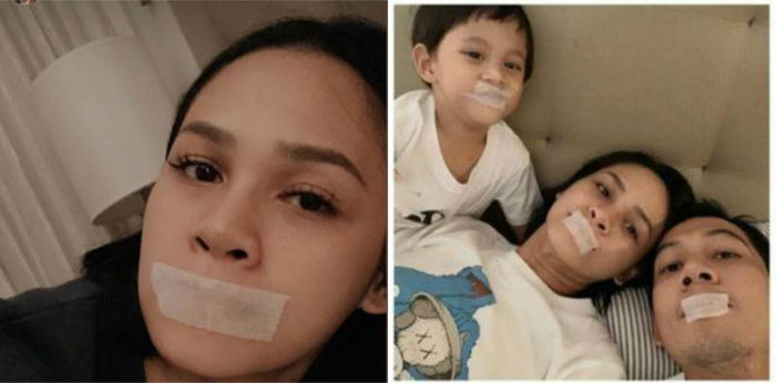 Andien Aisyah memakai plester di mulut saat tidur, apa alasannya?