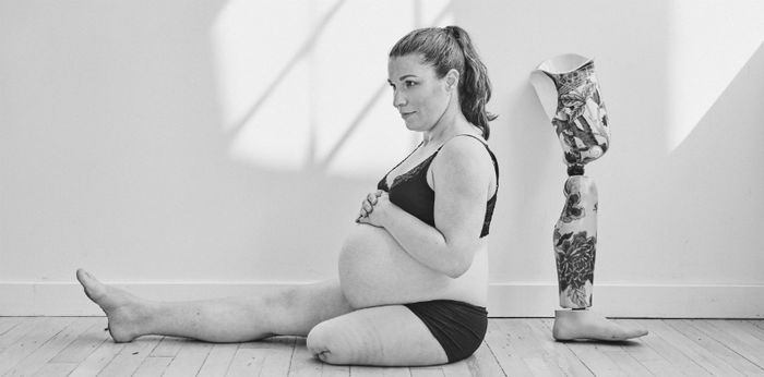 Inspiratif! Punya satu kaki, ibu ini percaya diri melakukan sesi foto kehamilan