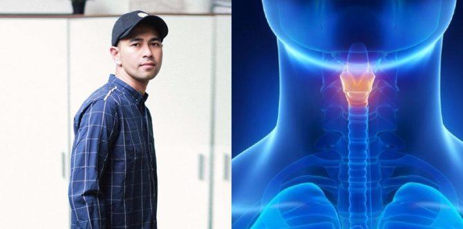 Raffi Ahmad sakit, "Saya harus cuti panjang agar bisa operasi."