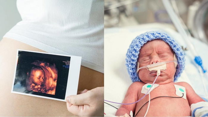 10 Cara Mencegah Bayi Lahir Cacat yang Perlu Diperhatikan