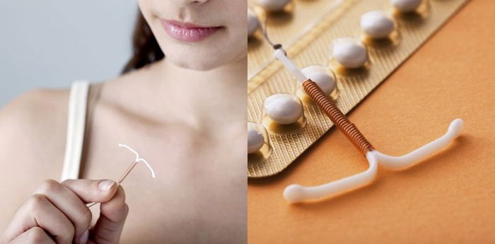 Pakai KB IUD tapi telat menstruasi apakah tanda 'kebobolan'? Ini penjelasan dokter