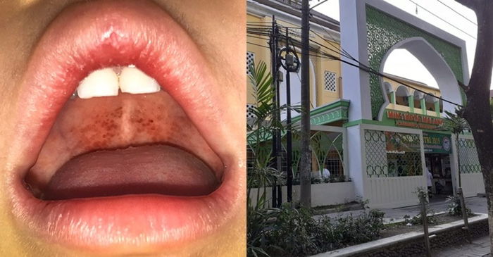 Positif carrier difteri, ratusan siswa sekolah ini diliburkan selama 5 hari, waspada gejalanya!