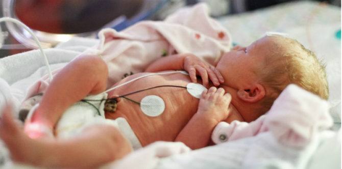 Jarang Terjadi! Seorang Bayi Perempuan Usia 5 Hari Mengalami Menstruasi, Apa Penyebabnya?