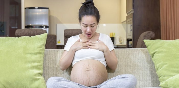 Stretch Mark Ibu Hamil Bikin Pusing? Ini Cara Mencegah dan Menghilangkannya