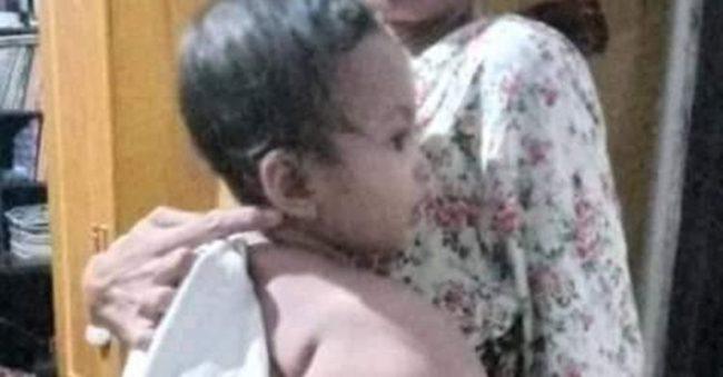 Benjolan di pundak membuat balita asal Jawa Timur ini kesakitan luar biasa
