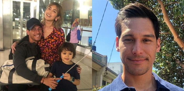 Jalani operasi cangkok kulit di Australia, Richard Kylie: "Aneh, badanku sudah berubah,"