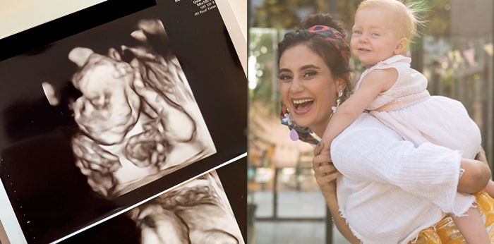 Tunjukkan foto hasil USG, Marissa Nasution hamil anak kedua?