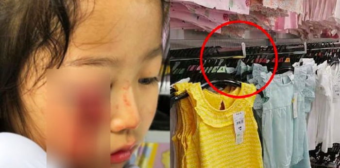 Jatuh menimpa gantungan baju, anak ini hampir buta, peringatan untuk Parents