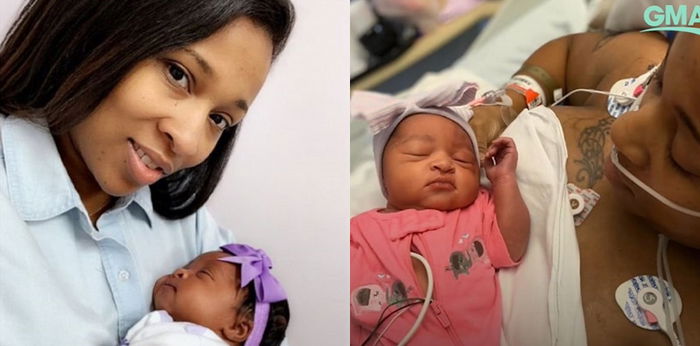 Kena serangan jantung saat hamil, Ibu ini harus melahirkan secara prematur