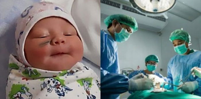 Akibat kelalaian dokter, wajah bayi ini alami luka sayatan saat operasi caesar