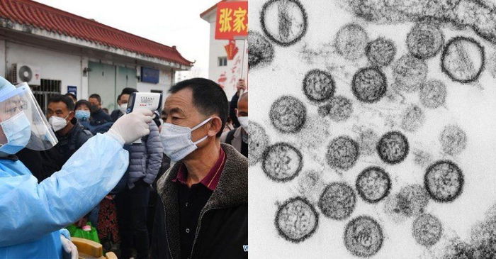 Seorang pria tewas akibat hantavirus, gejalanya mirip covid-19!