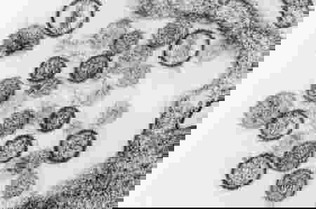 hantavirus