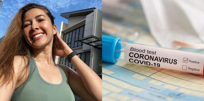 Andrea Dian positif terinfeksi Corona dengan riwayat autoimun