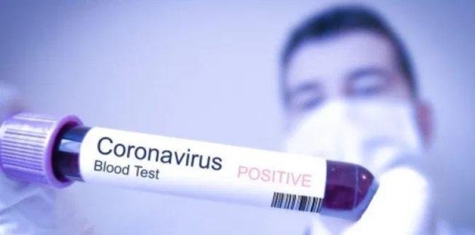 Breaking news! Ibu dan anak di Indonesia positif virus corona, bagaimana bisa tertular?