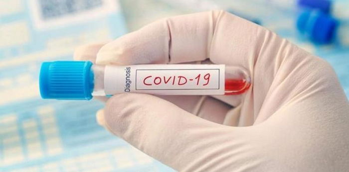 Rapid test bisa deteksi virus corona lebih cepat, bagaimana prosedurnya?