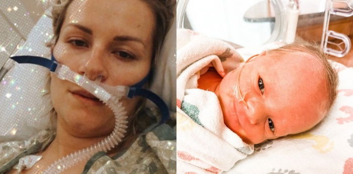 Kisah pasien positif corona melahirkan saat koma, "Aku mendapat keajaiban"