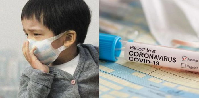 Penelitian terbaru: Covid-19 lebih banyak dialami anak lelaki daripada perempuan