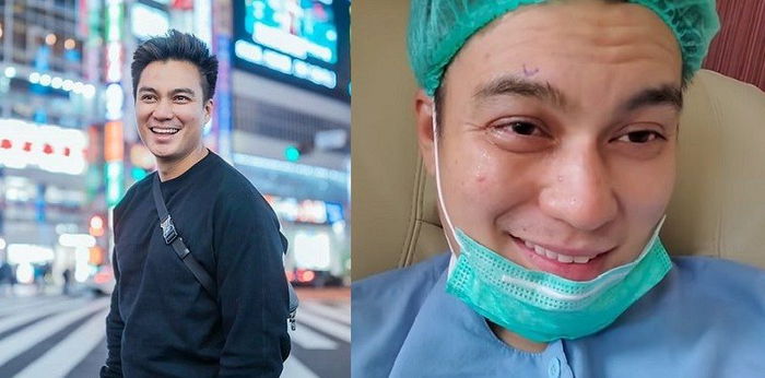 Jalani operasi mata, Baim Wong berharap bisa membantu sesama pasien katarak