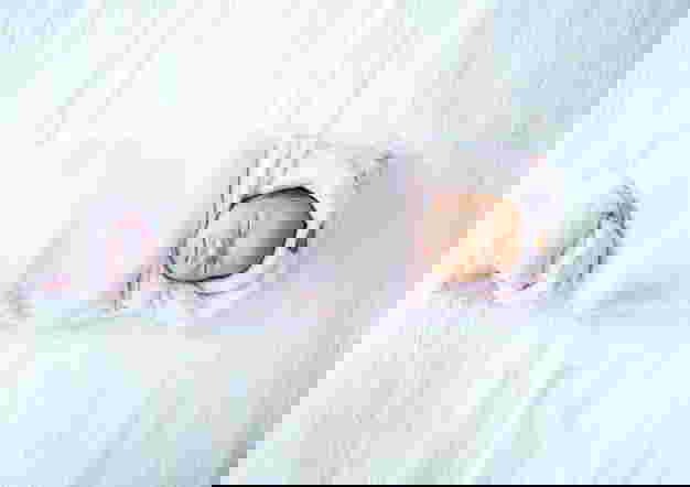 Experiencing Moebius Syndrome, This is the Story of a Baby Born Without Facial Expressions