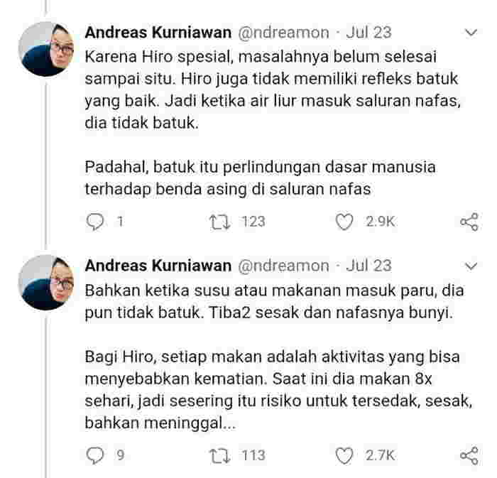 bayi dengan moebius syndrome