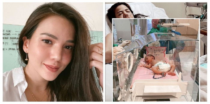 9 Hal yang Dilakukan Alice Norin Menjalani Kehamilan Plasenta Akreta