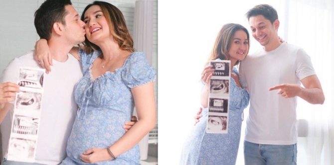 Menanti 3 Tahun dan Alami PCOS, Istri Andrew Andika Hamil Anak Pertama