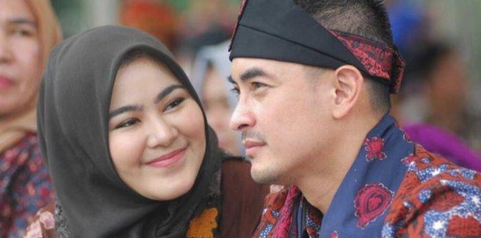 Zumi Zola Alami Gangguan Penglihatan, Mantan Istri Berikan Penjelasan