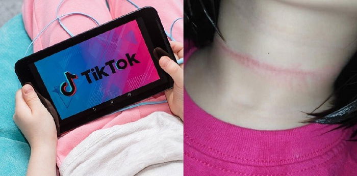 Bocah 4 Tahun Hampir Meninggal karena TikTok Challenge, Peringatan untuk Parents