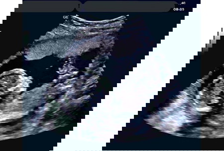 istri hamil dengan pria lain