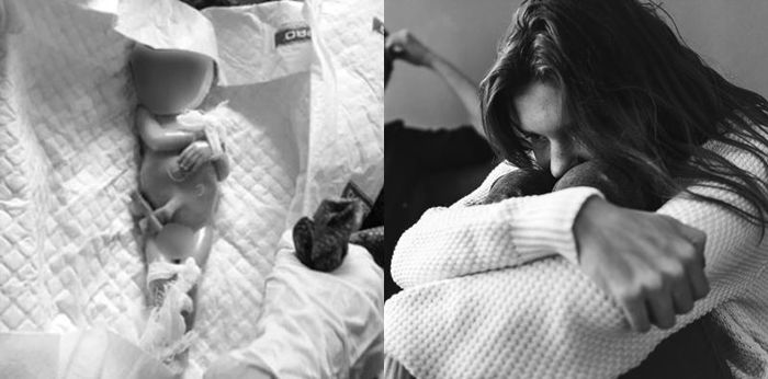 "Bayiku Meninggal Setelah Lahir dengan Berat 600 Gram," Kisah Ibu Alami Plasenta Previa