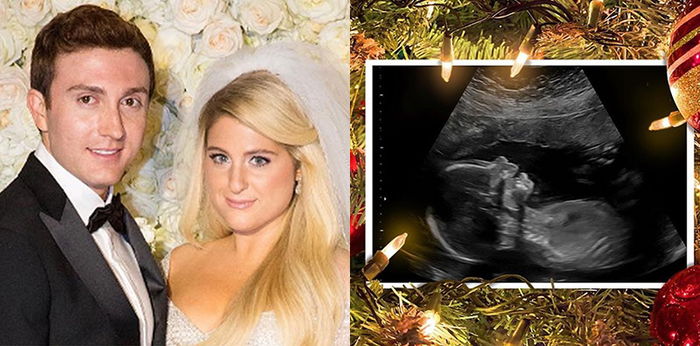 Umumkan Hamil Anak Pertama, Meghan Trainor: "Sangat Bahagia dan Tidak Sabar"