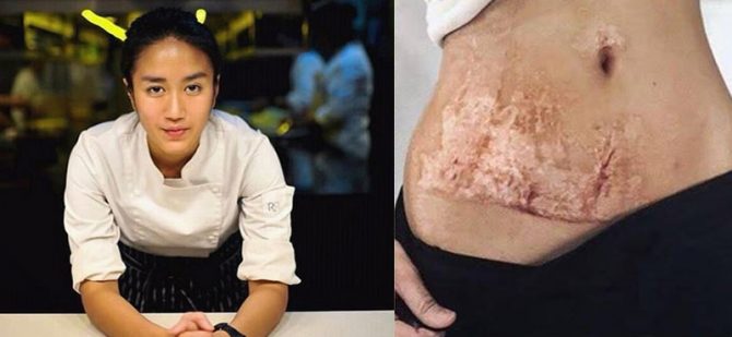 Kisah Chef Renatta, Pernah Terbakar saat Masak hingga Ditolak Kerja