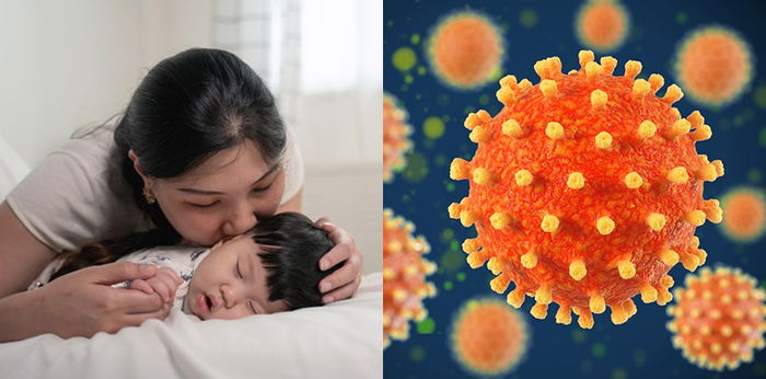 Waspada Herpes pada Bayi, Bisa Berisiko Kebutaan Hingga Meningitis