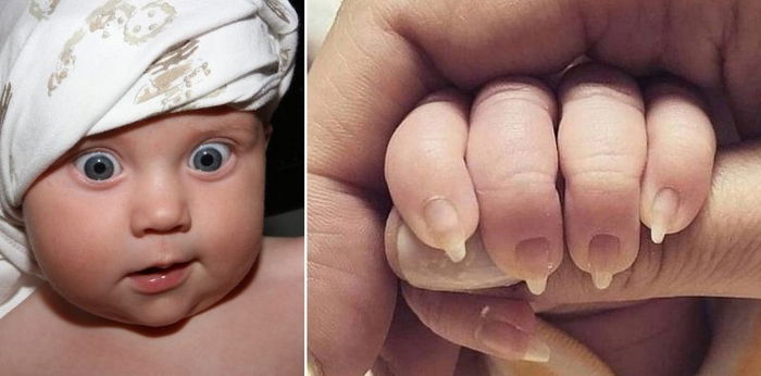 Ibu Ini Dikritik Pedas karena Sengaja Menajamkan Kuku Bayi, Apa Bahayanya?