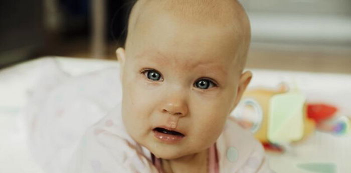 Bayi Rewel karena Hidungnya Tersumbat? 12 Tips Ini Bisa Bantu Mengatasinya