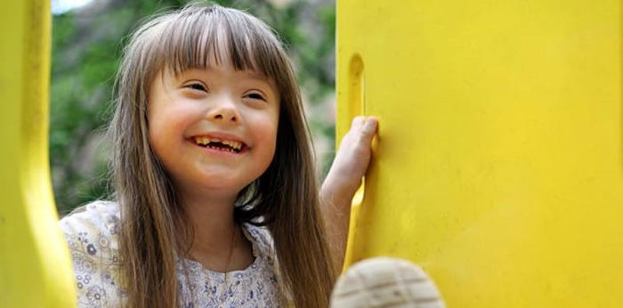 5 Fakta Hari Down Syndrome Sedunia, Diperingati Setiap 21 Maret