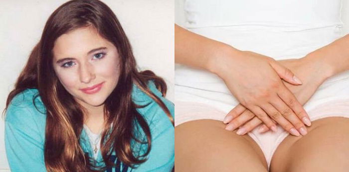 Terlahir Mengidap Sindrom MRKH, Perempuan Ini Tak Punya Rahim dan Vaginanya Abnormal