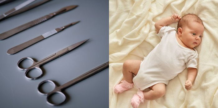 6 Fakta Soal Sunat Anak Perempuan, Hati-hati Bukan Tindakan Medis!