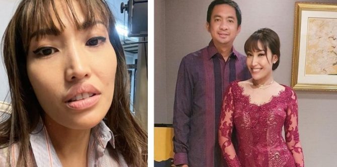 Bibir Ayu Dewi Tampak Seperti Dioperasi, Begini Reaksi Protes Sang Suami!