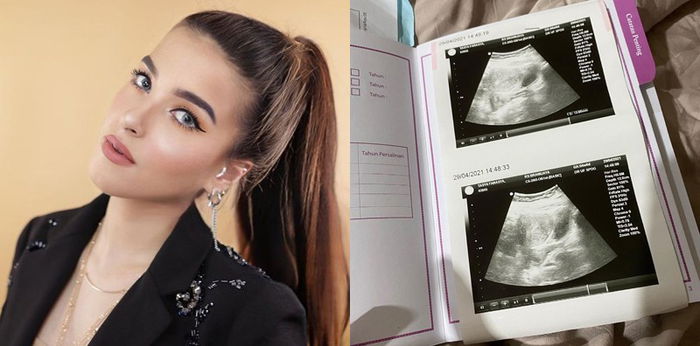 Sempat Hamil Anak Kedua, Tasya Farasya Alami Keguguran
