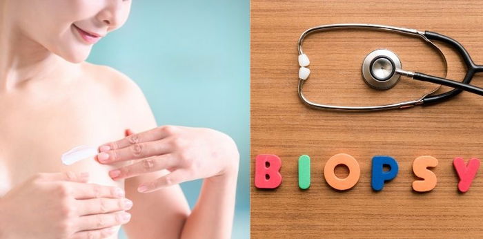 Penjelasan Lengkap Seputar Biopsi Payudara: Jenis, Risiko, Prosedur, Hingga Hasilnya