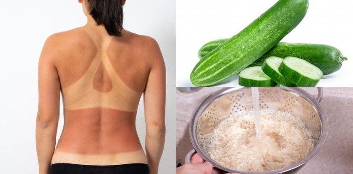 Kulit Belang Bikin Tak Percaya Diri? Atasi dengan 7 Bahan Alami Ini!